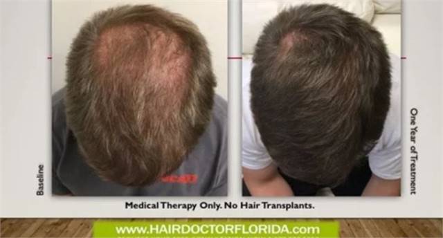 Hair Transplant Surgeon